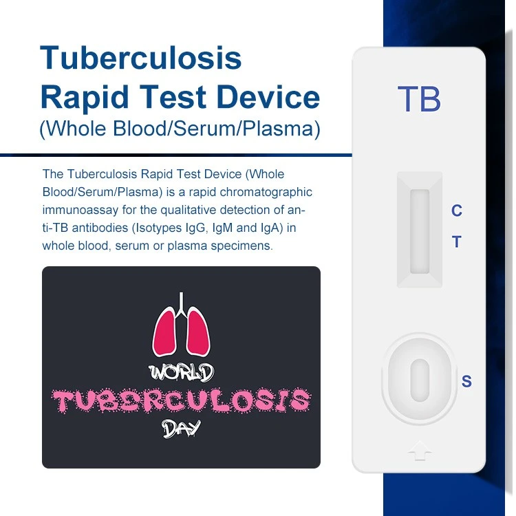 Tuberculosis (TB) Rapid Test price